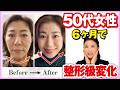 【顔の下半分】50代女性が6ヶ月でここまで若返った方法!もたつき口元を引き上げる究極のリフトアップ術!