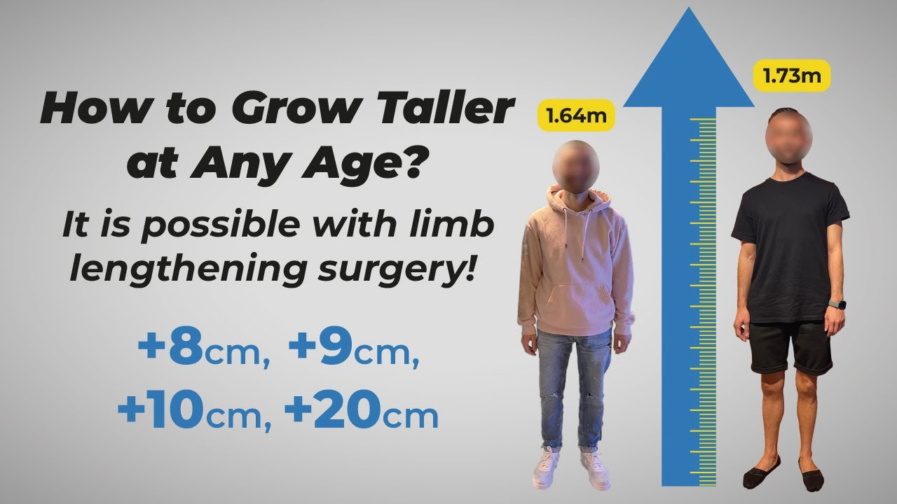 How to Grow Taller at Any Age? It's possible with Limb Lengthening