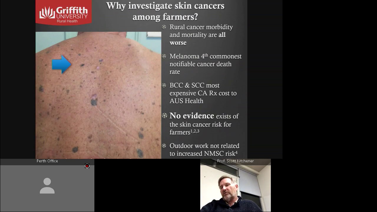 Research update Skin Cancer Screening YouTube