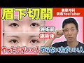 眉下切開法の動画