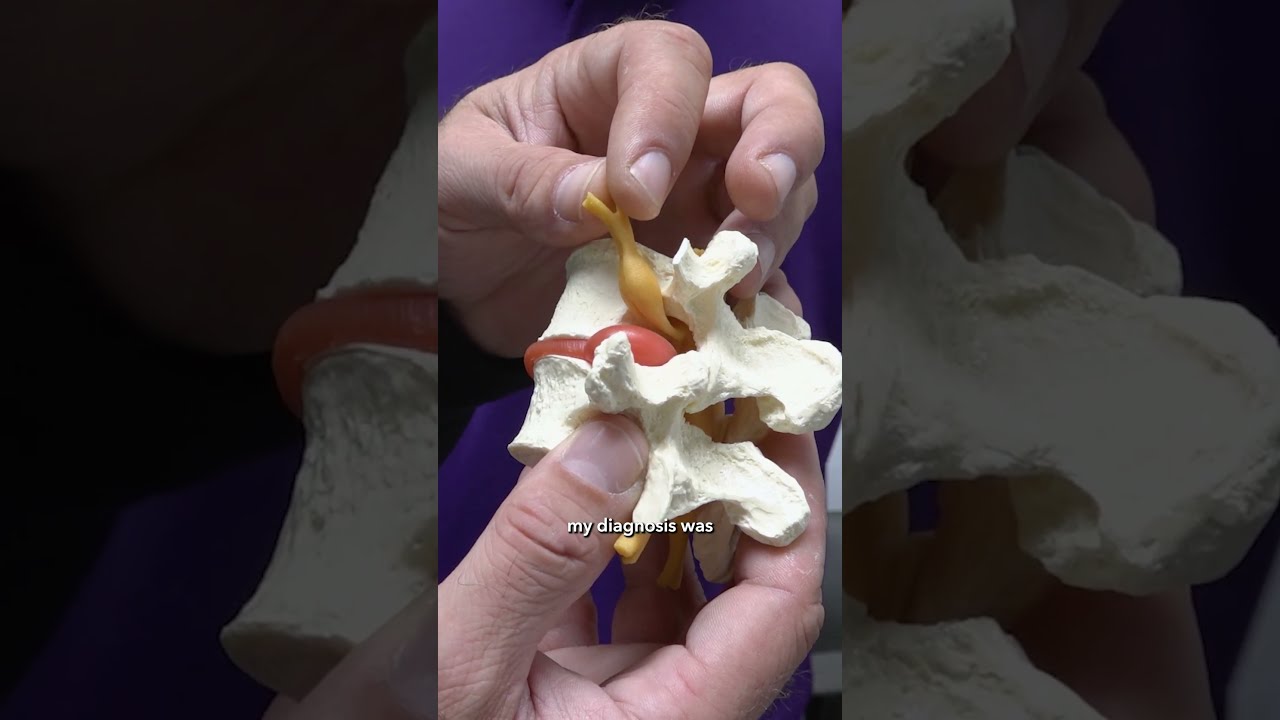 Bulging Disc Surgery Erich S Story