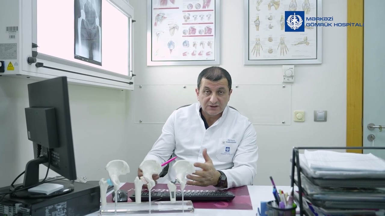 Bud çanaq oynaqlarının artrozu nədir?