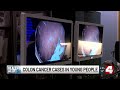 Colon cancer cases rising in younger adults as doctors urge early screening