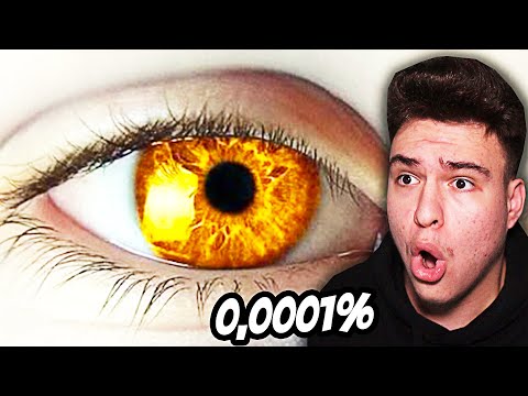 Video: Cea mai rară culoare a ochilor - ce este?