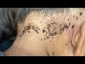 Remove hundred lice from black hair  pick out all thousand lice from her long hair