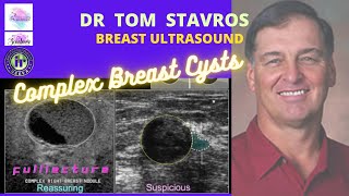 Breast cysts that aren't simple | DR Tom Stavros | Breast Ultrasound | BIRADS II lesions screenshot 3