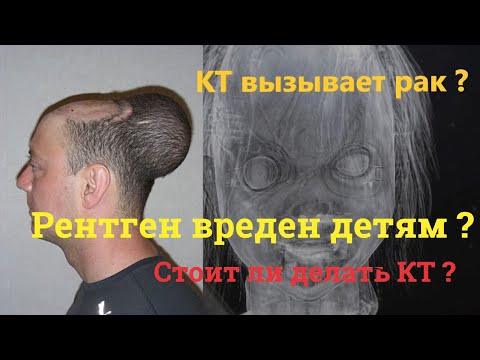 Видео: Рентгенов рак: Знайте своя риск и как сте защитени