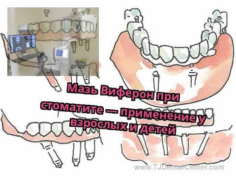Мазь Виферон при стоматите — применение у взрослых и детей Мазь Виферон при стоматите — применение у взрослых и детей