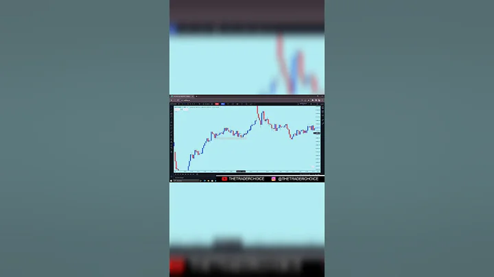 Trading Rules Setup | The Trader Choice #shorts  #trading #stockmarket #optionstrading  #scalping