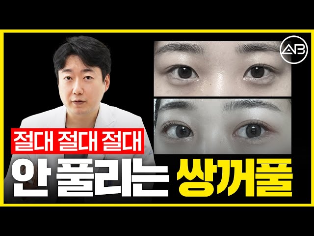 쌍꺼풀 100% 안 풀림 보장?! 풀릴 수도 있습니다! | 에이비성형외과