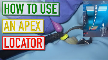 ⚠️ Apex Locator FAIL? Why Your Working Length Might Be WRONG! 🔥