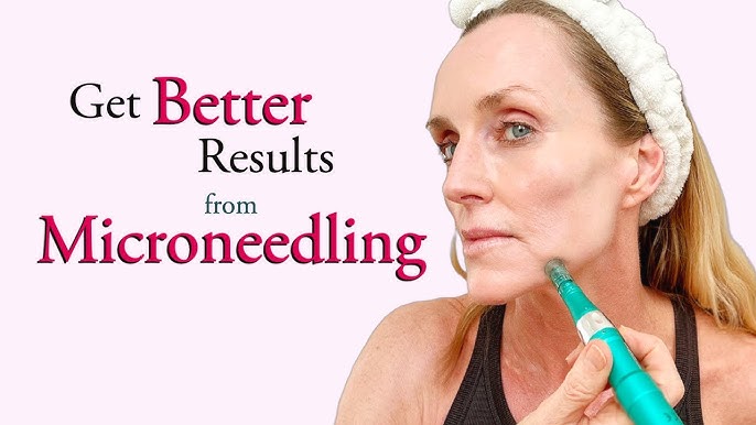 How to Microneedle at Home Safely With Dr. Pen: A Comprehensive