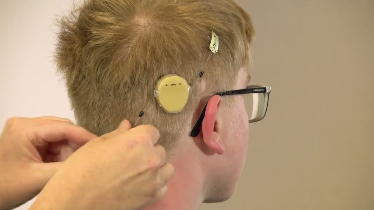 Kanso® 3: Dispositivo Kanso Halo