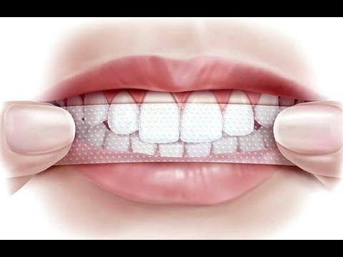 Как отрастить себе клыки в домашних условиях 273