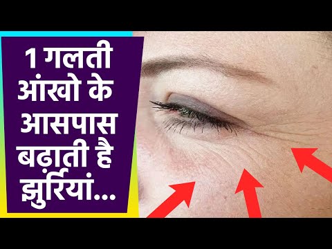 वीडियो: आंखों में झुर्रियां क्या हैं?