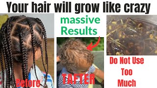 How I Use This Herbal To Grow My Hair Longer And Thicker In Shorter Periods| Better Than Clove Water