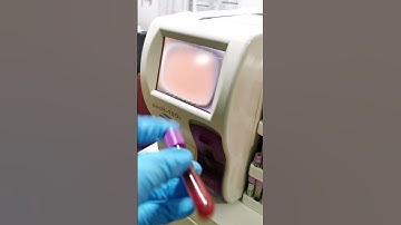 Everyday Laboratory Routine #medtech #laboratory #cls #mls #lab #bloodcells #blood #cbc #chem