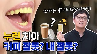 Coffee Is The Main Reason of Teeth Staining?!｜Here Are The True Facts of Wrongfully Accused Coffee