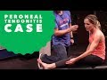 E188: Peroneal Tendon Injury after Running - Treatments, Therapy and Rehab