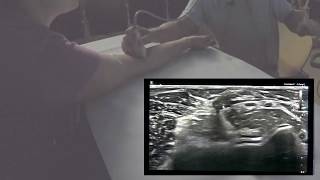 basic ultrasound examination of the elbow