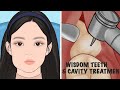 ASMR Wisdom Teeth & Cavity Treatment Animation /Tartar removal ASMR animation part2 / Satisfying