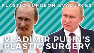 Vladimir Putin Before / After: Facial Fillers, Botox, and plastic surgery?!