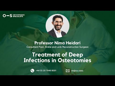 Bone infection — OS talk & treatment of complications of tibial osteotomy