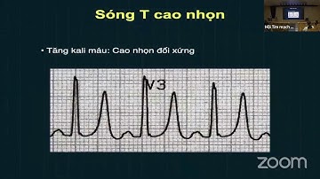 Điện tâm đồ (ngày 8): ĐTĐ thiếu máu cơ tim và case lâm sàng (p1/2)