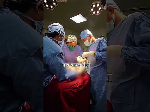 Tedha Paon Ka Ilaj: Foot Deformity Correction Surgery (Success Story) #shortsfeed