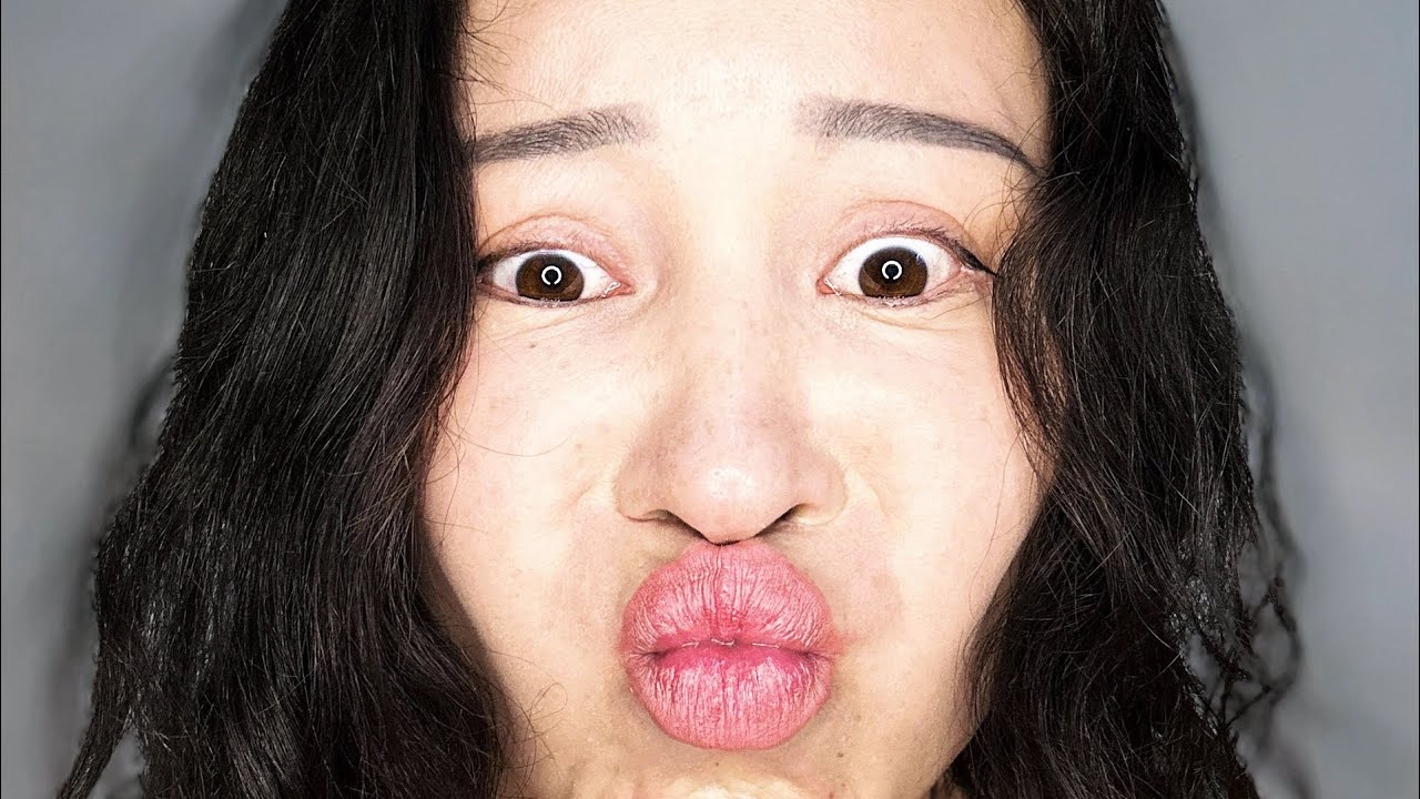 Удаление шрама, бородавок , рубцы #шрамы #рубцы #косметология #рубцы # ...