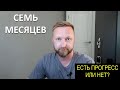 СЕМЬ МЕСЯЦЕВ ПОСЛЕ ВТОРОЙ ПЕРЕСАДКИ ВОЛОС