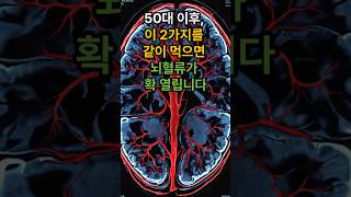 “50대 이후엔 뇌혈류 15% 감소 하지만 이 두 가지면 되살아납니다. 의사들이 추천하는 뇌혈류 회복 음식 조합”#식궁합#뇌혈류개선#고등어#시금치 효능#50대건강#뇌건강