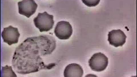 White Blood Cell Chases Bacteria