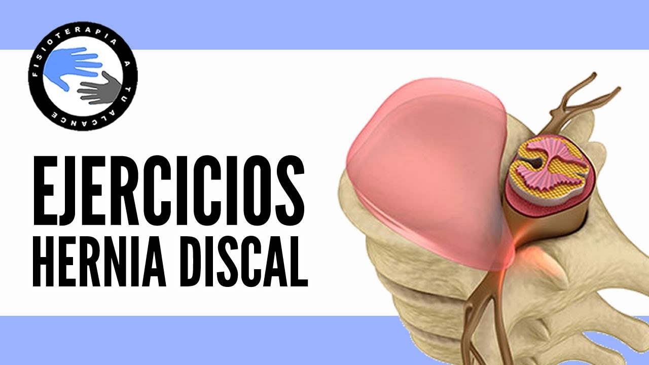 Hernia discal lumbar, programa de ejercicios para la fase intermedia