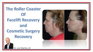 The Roller Coaster of Facelift Recovery and Cosmetic Surgery Recovery