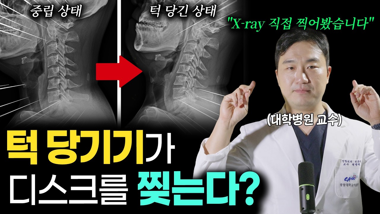 턱 당기면 목 디스크 터진다? 대학병원 교수가 목 엑스레이 찍어서 확인해 봤습니다(맥켄지 운동 vs 턱 당기기 운동)