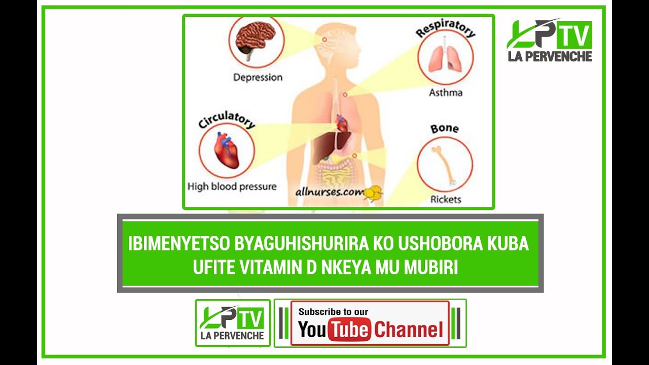 IBIMENYETSO BYAGUHISHURIRA KO USHOBORA KUBA UFITE VITAMIN D NKEYA MU MUBIRI