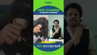 Deep Cleaning of Greasy Dandruff naturally - 90% success rateAdonHairKit adonhaircare