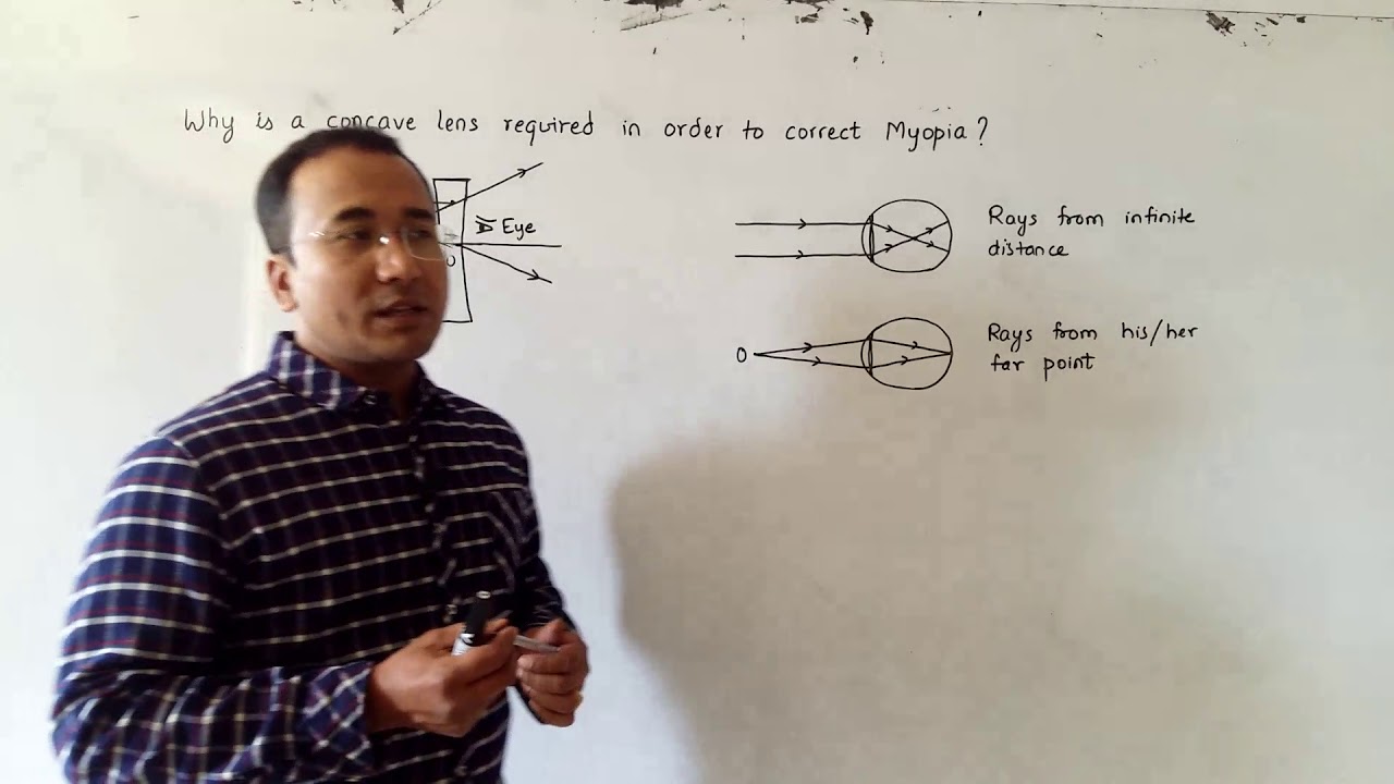 Why is a concave lens required to correct Myopia?