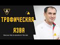 Трофическая язва - лечение. Флеболог Москва.