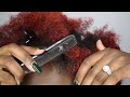 HUGE FLAKES | ITCHY DANDRUFF | SCALP SCRATCHING EP32 #dandruff #scalpscratching