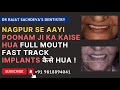 Nagpur to delhi for full mouth dental implants  fixed teeth with dental implants 