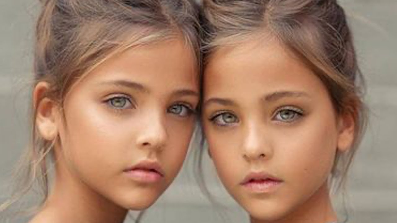 Wait Until You See the Most Beautiful Twins in the World Now - YouTube