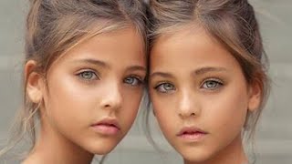 Wait Until You See the Most Beautiful Twins in the World Now Resimi