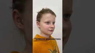 Отопластика ребенку в Москве. Результат пациента.Для записи на +7(981)888-88-74 #пластическийхирург