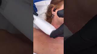 Rejuvenate Your Neck with #HIFU ✨