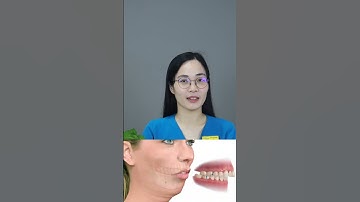 Niềng Răng Cải Thiện Như Nào? | Nha Khoa Minh Châu