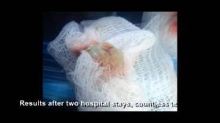 Herbal Remedy For Diabetic Foot Ulcer