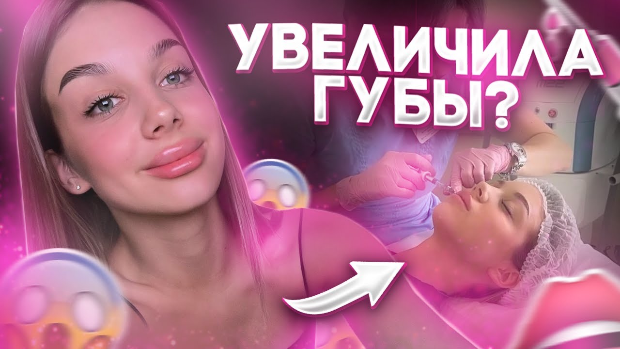 МОЯ ИСТОРИЯ УВЕЛИЧЕНИЯ ГУБ | БЫЛО БОЛЬНО ???