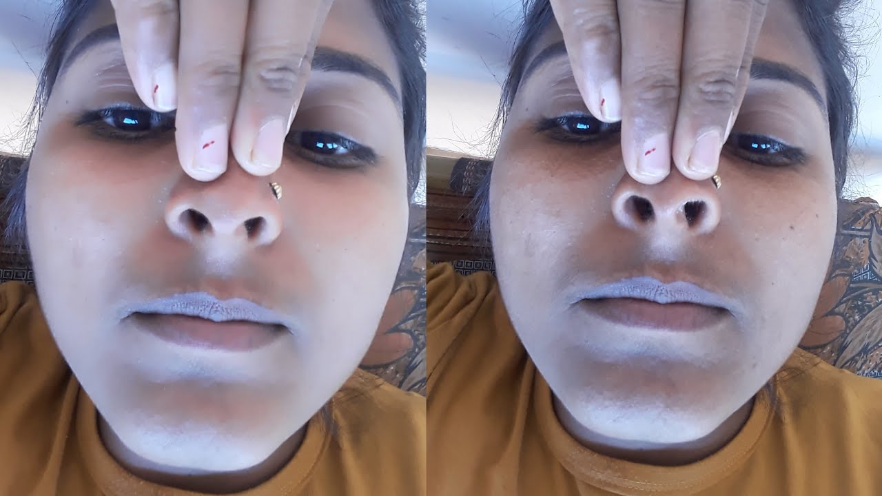 Village Girl Piggy Nose Massage Nose Massage Normal Nose Massage village-girl-piggy-nose-massage-nose-massage-normal-nose-massage